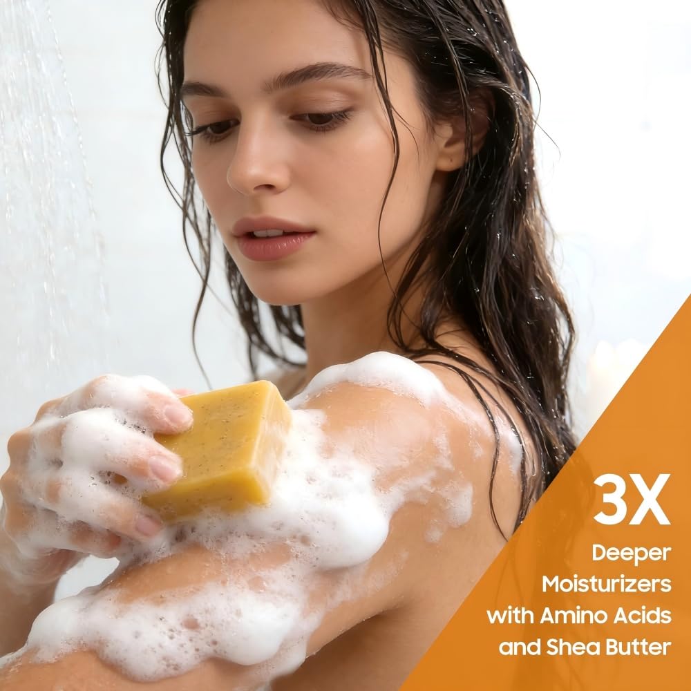 Lemon & Turmeric Soap Bar for Dark Spots, Powered by Kojic Acid & Vitamin C - Deeply Moisturizing with Amino Acids & Shea Butter - SLS Free for Face/Body