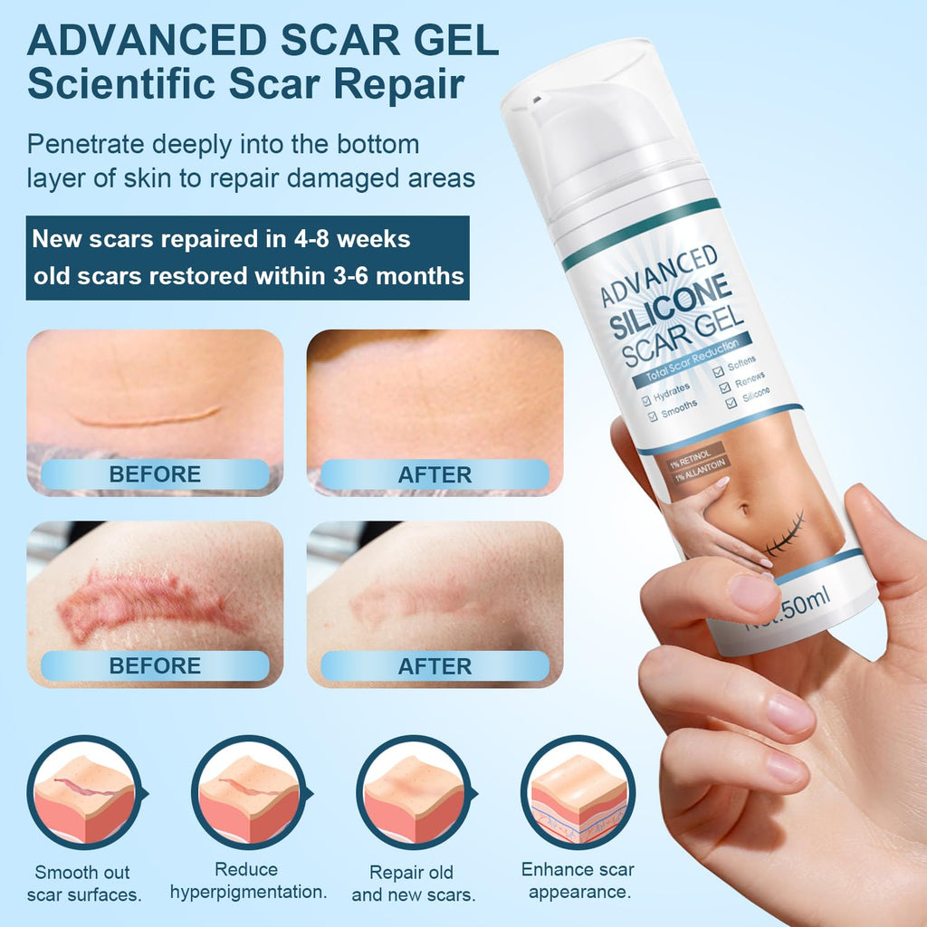Mitgary Advanced Scar Gel, Silicone Scar Gel, Treats Old and New Scars, Reduces the Appearance of Scars from, Body, Face, Stretch Marks, Surgical Scar, Keloids, Acne, Burns and More, 50g (1.7 Oz)
